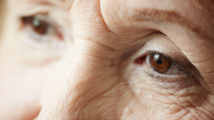 Idosa com degeneração macular