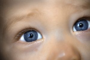 Saiba tudo sobre a catarata congenita: suas causas, seu diagnóstico e seu tratamento