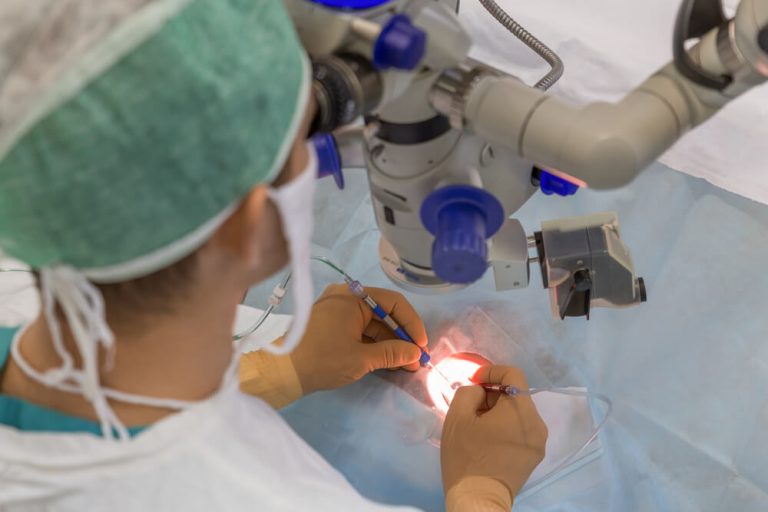 Cuidados antes e depois da cirurgia de catarata
