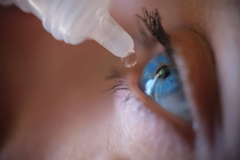 imagem de uma mulher pingando lagrima artificial no olho