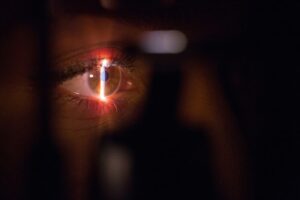 Imagem de um exame oftalmológico sendo realizado bem de perto do olho do paciente