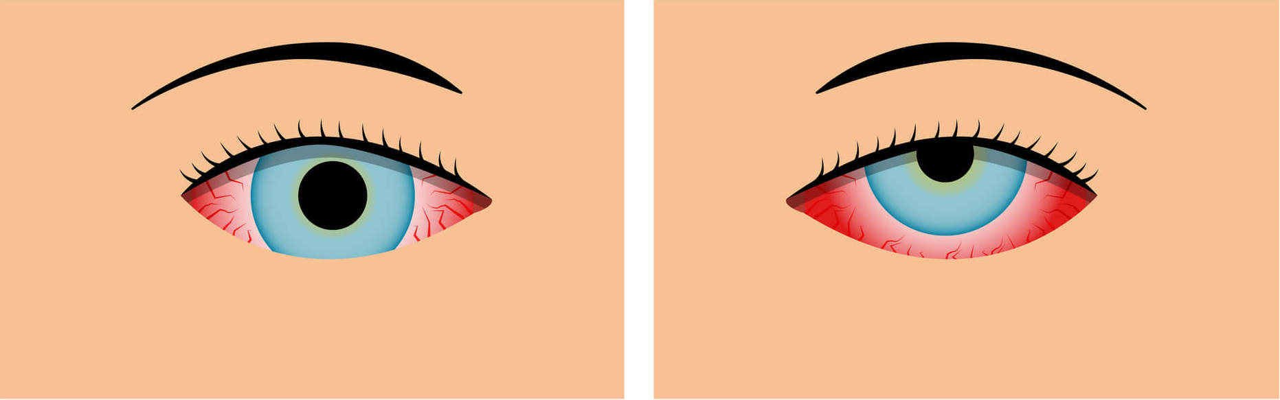 tudo sobre saude ocular inverno