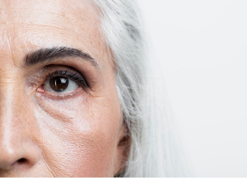 mulher idosa de cabelos branco com o olho inchado mostrando metade do rosto