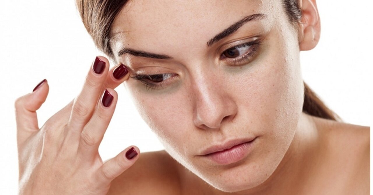 mulher com olhos rostos encostando uma das mãos na pálpebra direita