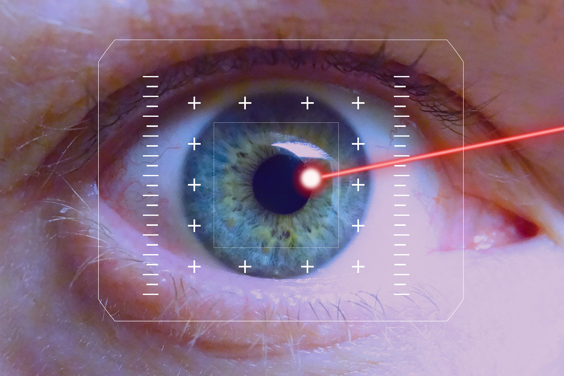 imagem de um laser incidindo sobre um olho