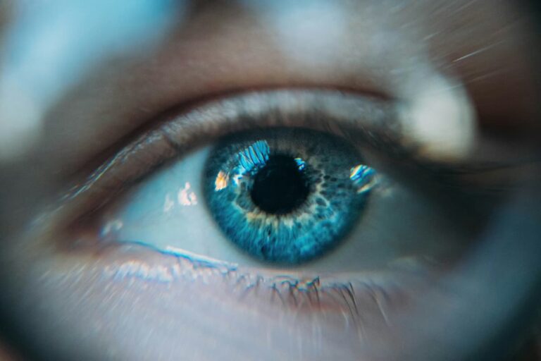 Olho azul de pessoa que sofreu com pressão intraocular