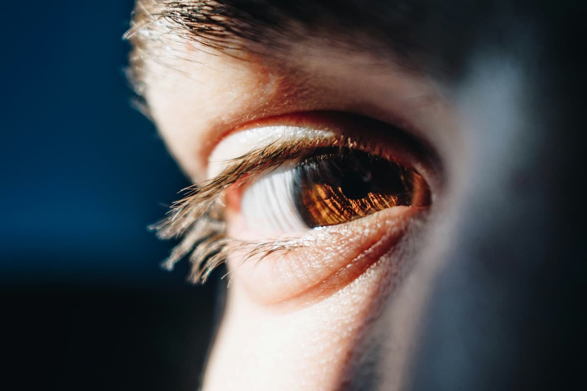 Uma foto de lado de um rosto mostrando o olho castanho de uma pessoa que passou pela cirurgia de blefaroplastia