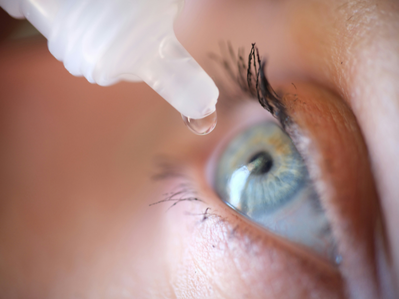 A imagem mostra um close-up de um olho humano, com foco em uma gota de colírio (eye drop) prestes a ser aplicada. A gota está saindo de um frasco plástico branco, típica embalagem de colírios. O olho está aberto, com o olhar direcionado para cima, e a gota está a ponto de cair diretamente no globo ocular.