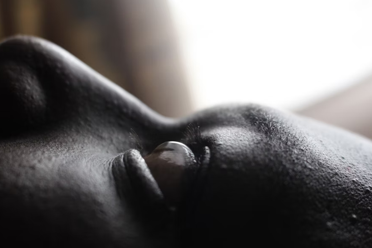 A cena está em penumbra, e a única parte iluminada é a córnea, que reflete uma luz brilhante. A córnea parece estar projetada para fora, com uma curvatura acentuada, o que pode estar associado a uma condição como o ceratocone.