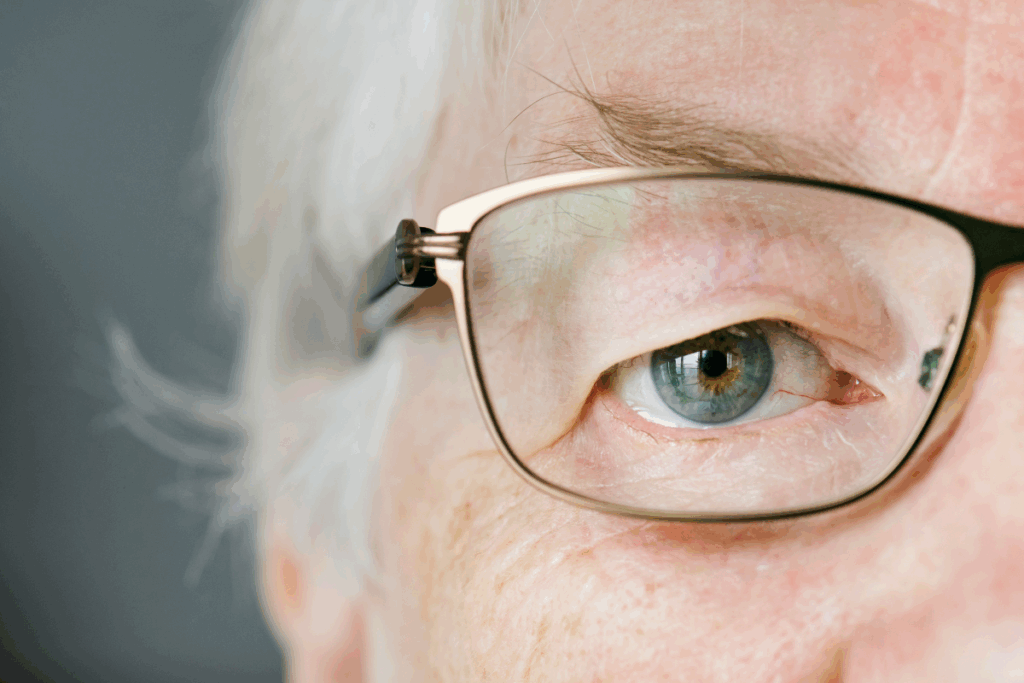 A imagem é um close-up do olho de uma pessoa idosa, possivelmente uma mulher, com cabelo branco. O foco está no seu olho esquerdo, que tem a íris em um tom de azul esverdeado com um leve anel cinza na borda