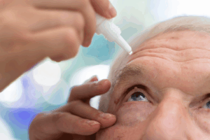 👁️ Descrição da Imagem A imagem é um close-up focado na aplicação de colírio nos olhos de uma pessoa idosa com catarata.