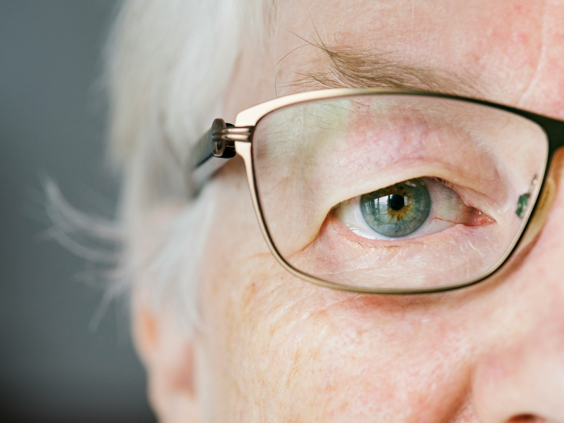 idoso com catarata ou glacoma
